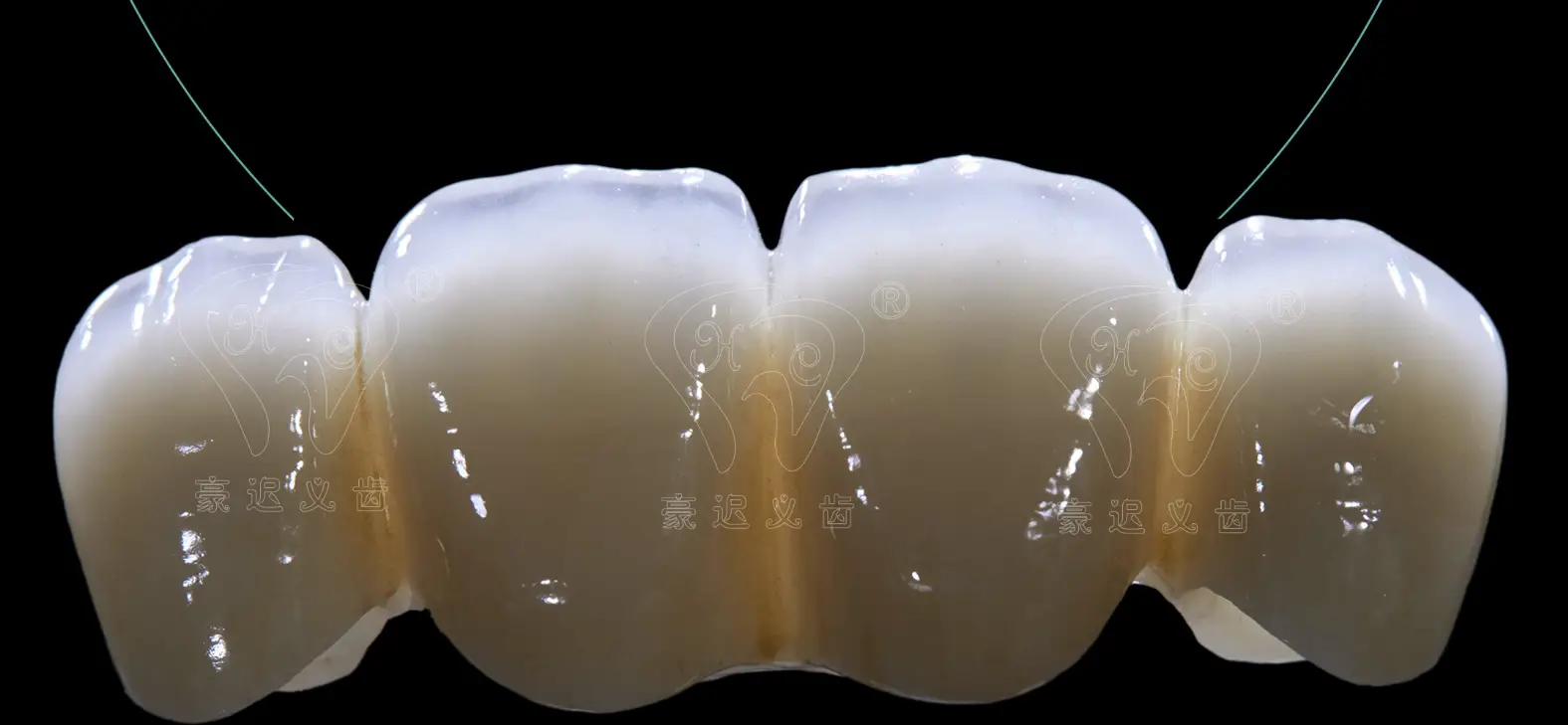 重慶高新技術(shù)義齒企業(yè)集群崛起：技術(shù)賦能下的質(zhì)量革命